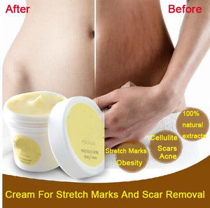 Thailand pasjel precious Skin Body Cream  stretch marks remover - Girly Wavy